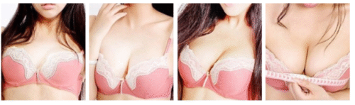 Meikefanbao-Full Firming Factor Papain photo review