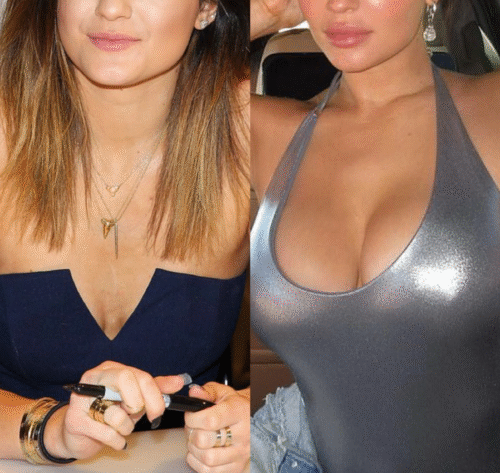 MOIKA Breast Enhancement Essential Oil photo review