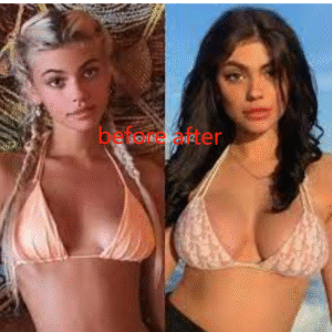 Click to view full screen Meikefanbao-Full Firming Factor Papain photo review