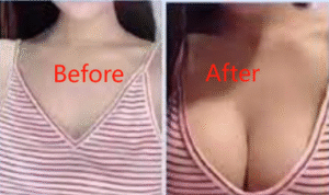 Meikefanbao-Full Firming Factor Papain photo review